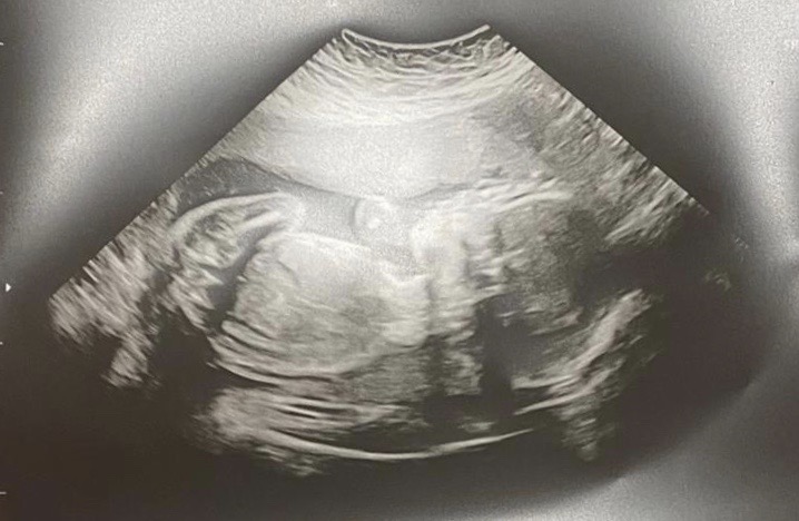 1e7b7ca3-7623-4dfd-96ba-b4113d854e21