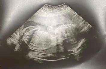 1e7b7ca3-7623-4dfd-96ba-b4113d854e21